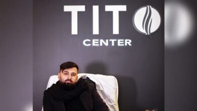 صورة توضيحية - مركز Tito نتائج مبهرة على مستوى زراعة الشعر