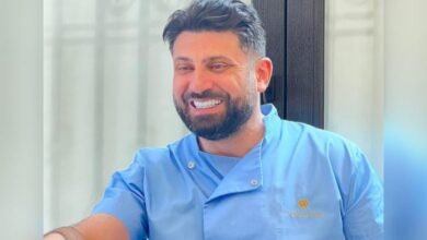 أحمد جبارة تستخدم قشرة السيراميك إيماكس في تصميم ابتسامة هوليوود